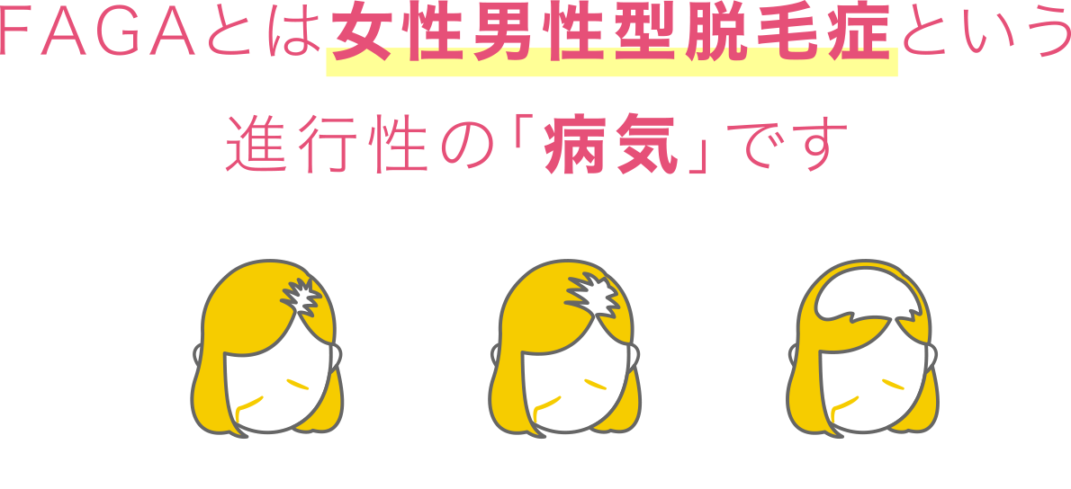 FAGAとは男性女性男性型脱毛症という進行性の「病気」です