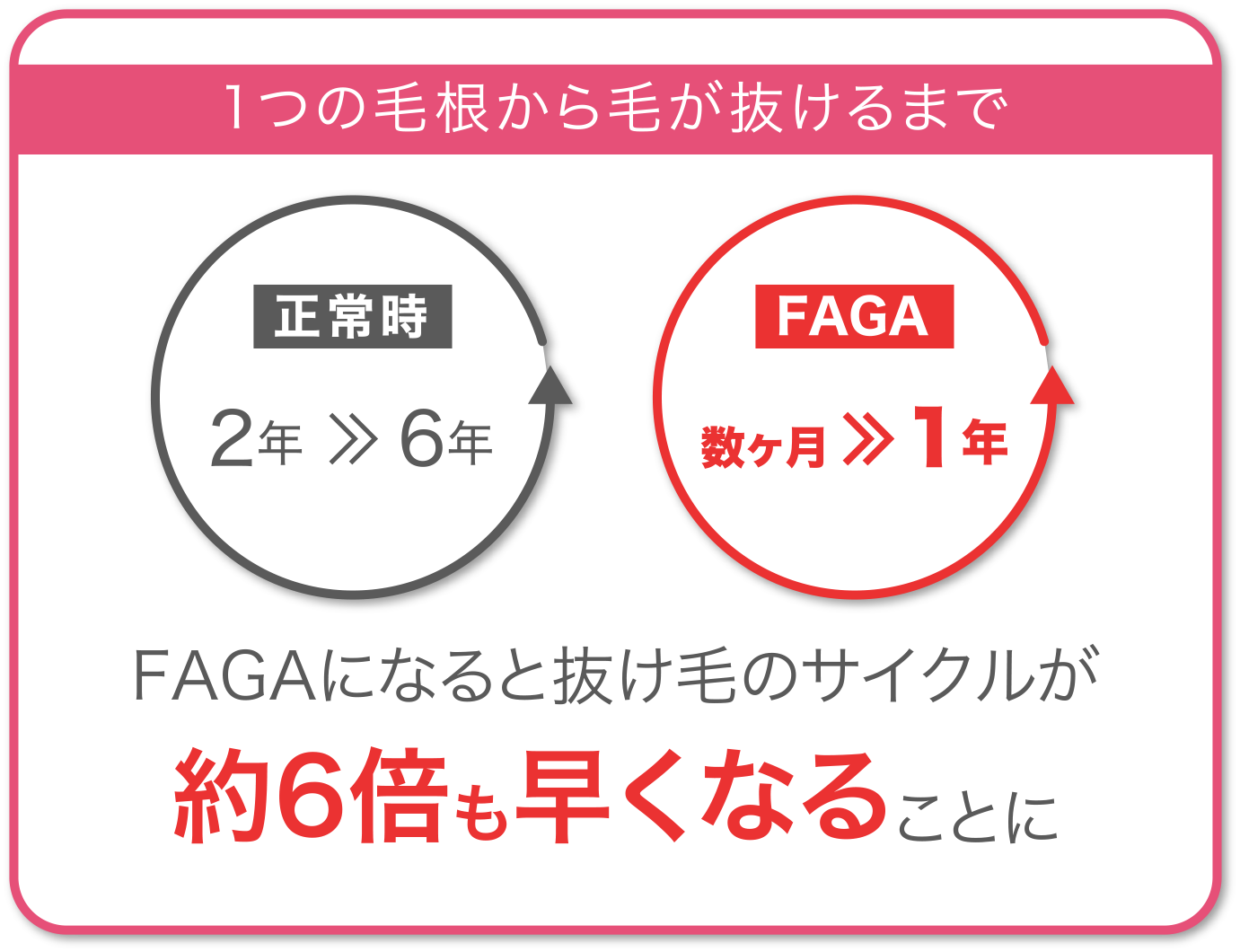 AGAになると抜け毛のサイクルが約6倍も早くなることに