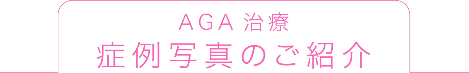 AGA治療症例写真のご紹介