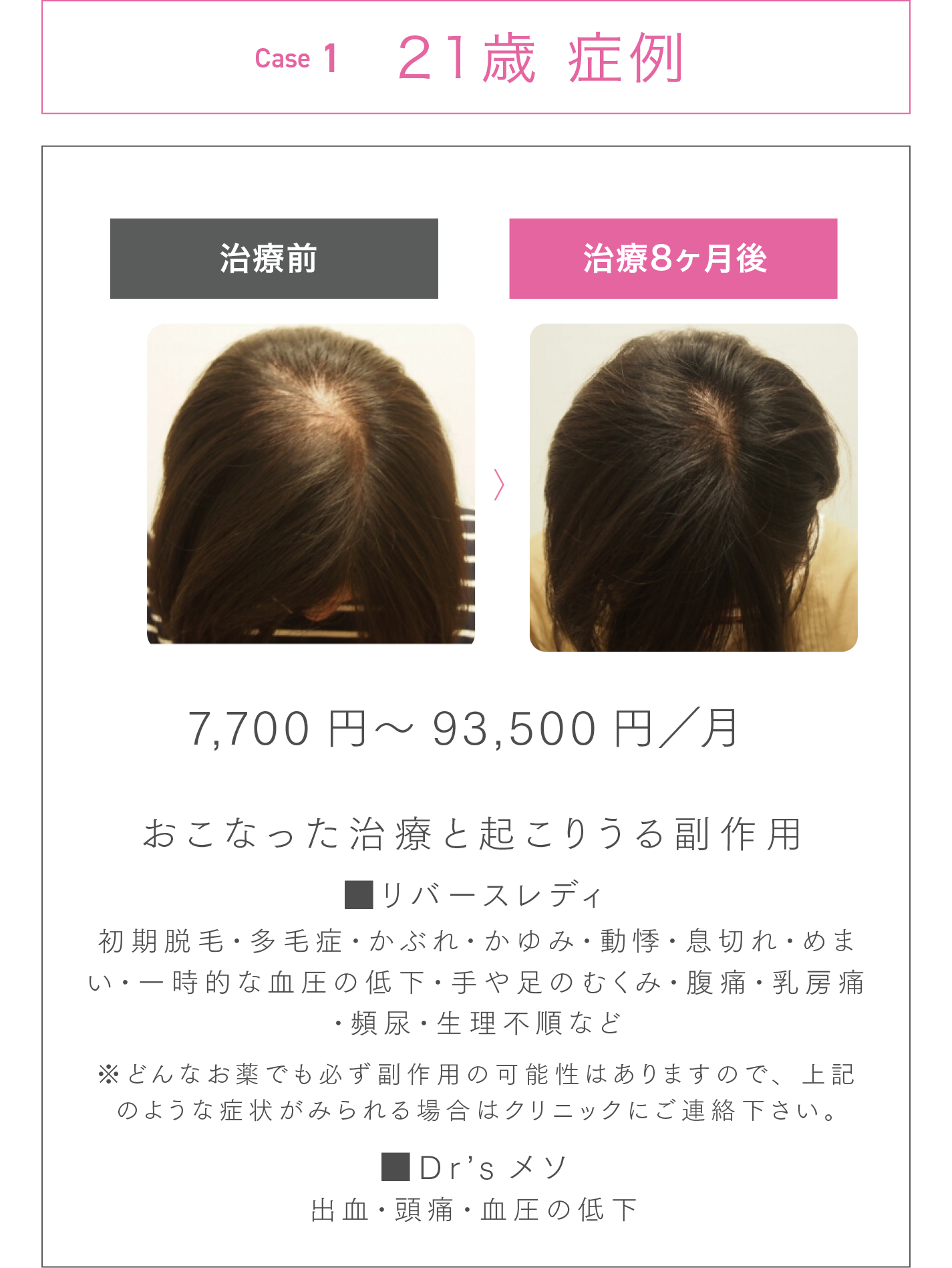 21歳 症例