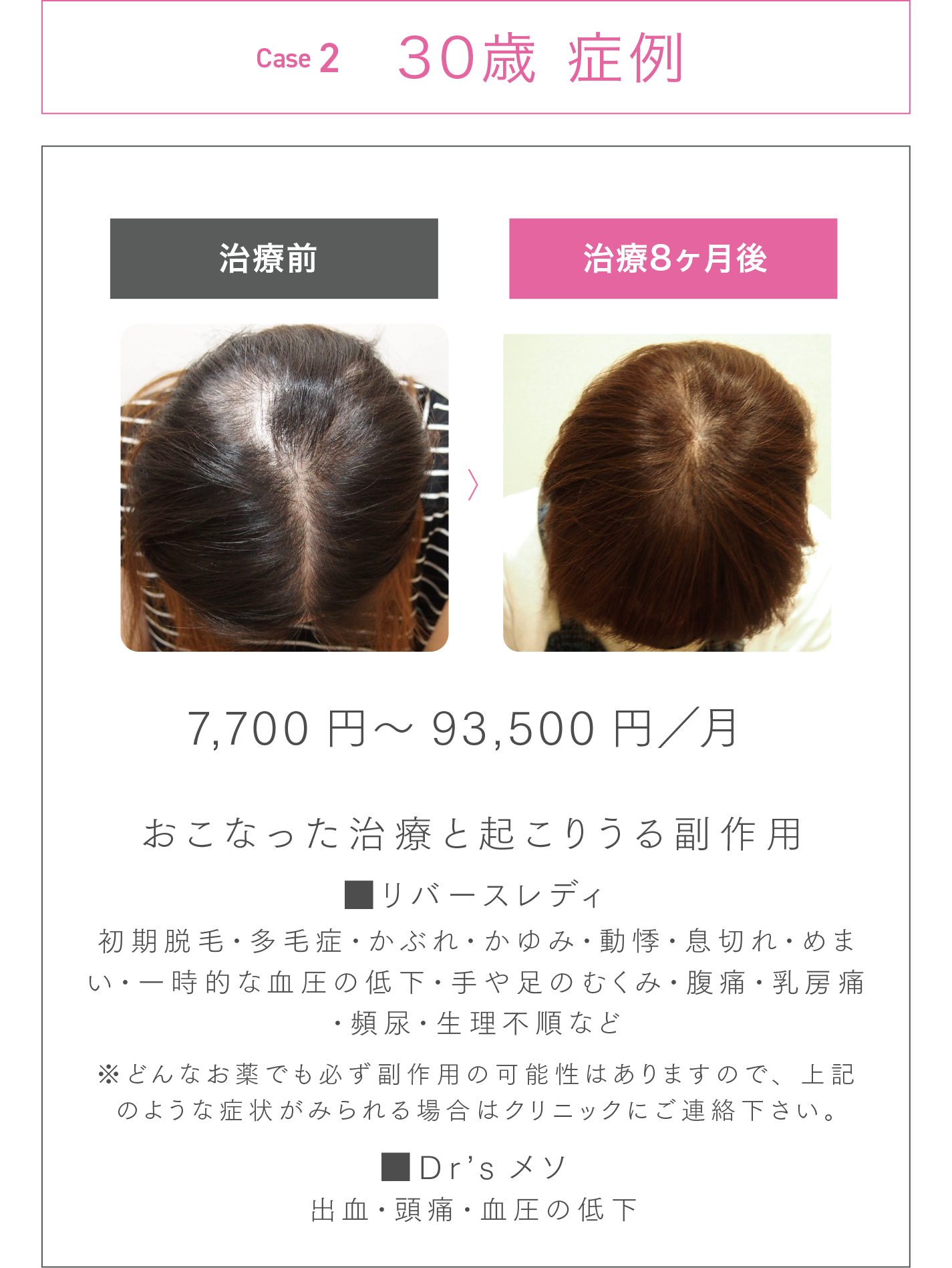 30歳 症例