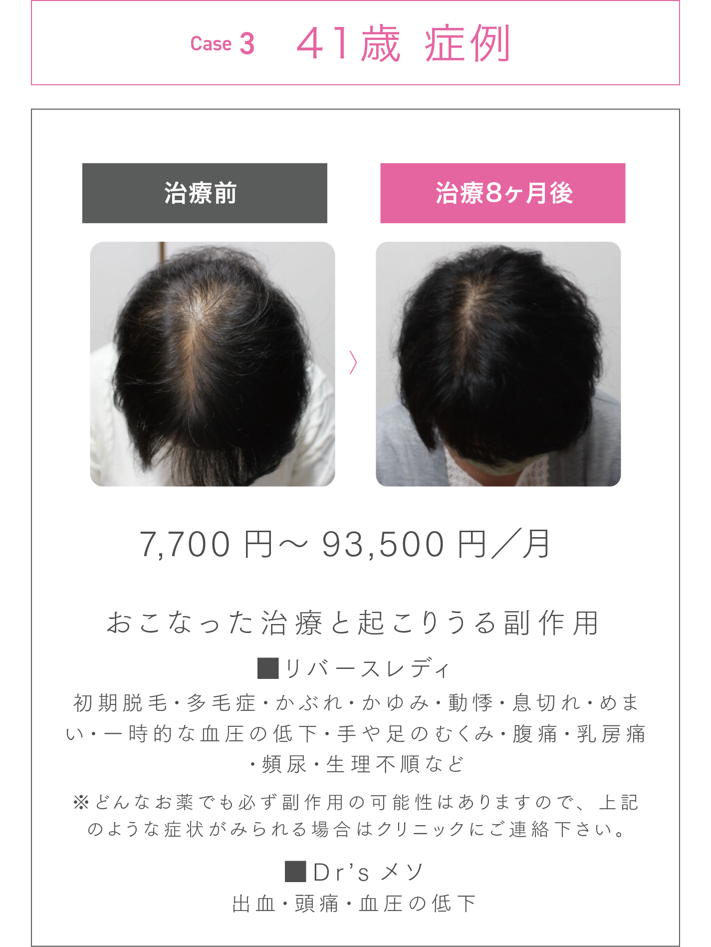 41歳 症例