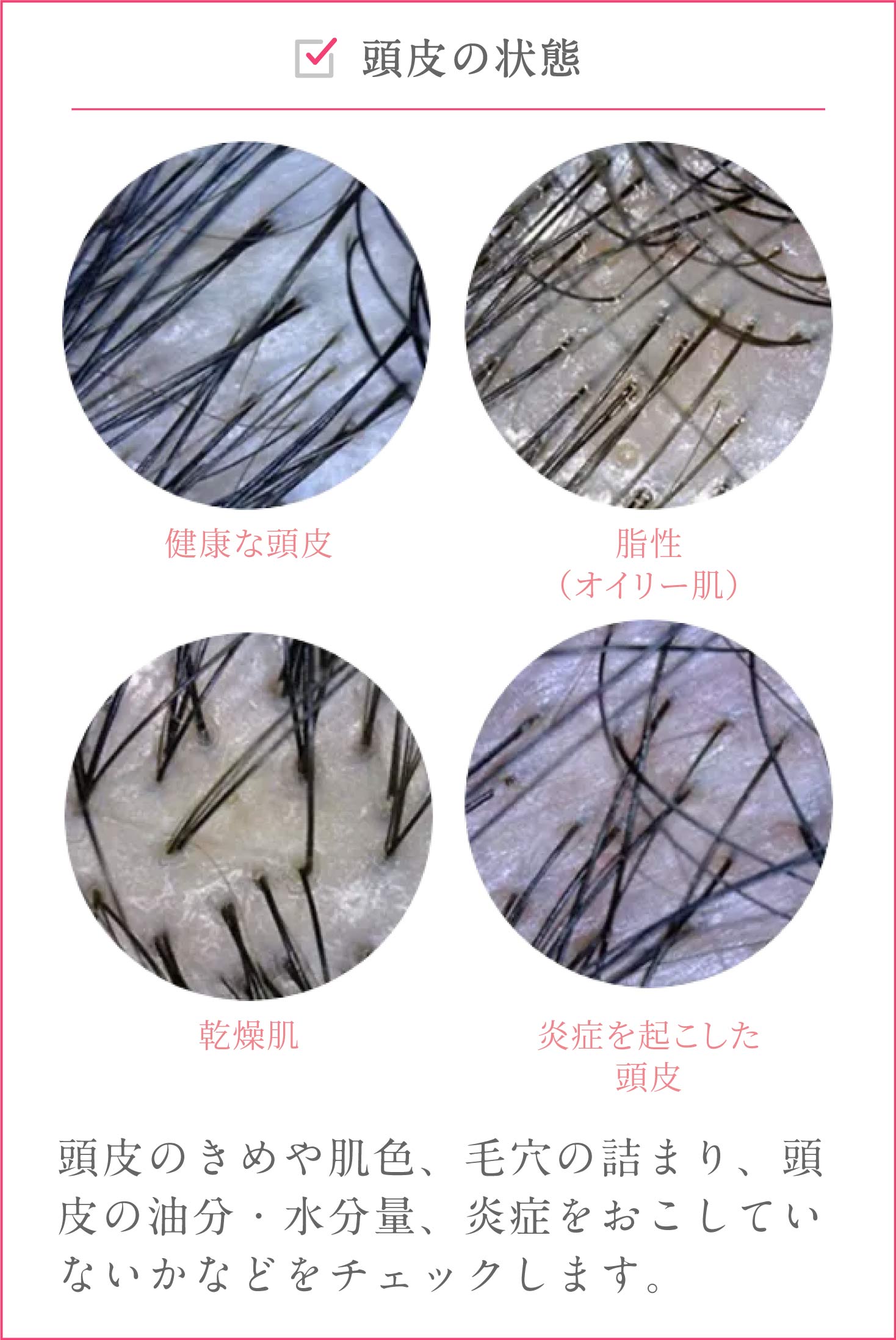 頭皮の状態