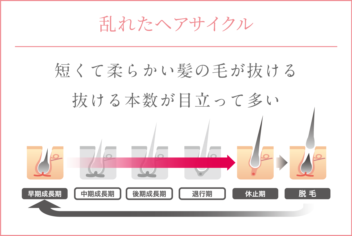 乱れたヘアサイクル