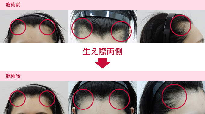 ヘアアートメイク施術例