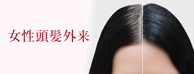 女性頭髪外来